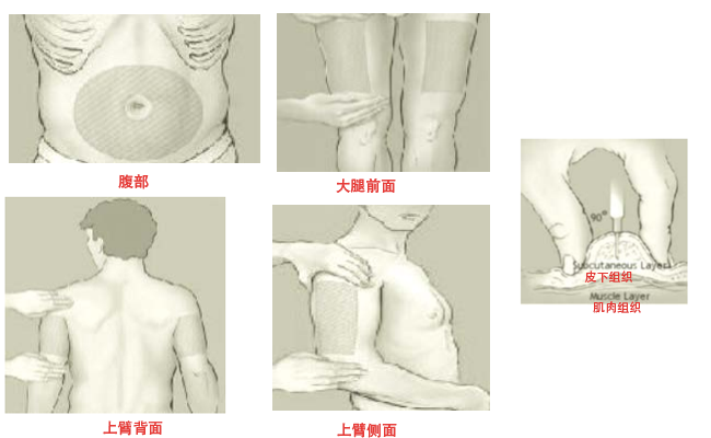用生物制剂，真的需要“打一枪换个地方”吗？