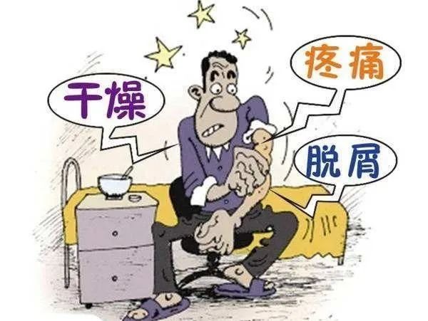 银屑病的相关知识，您真的了解吗？
