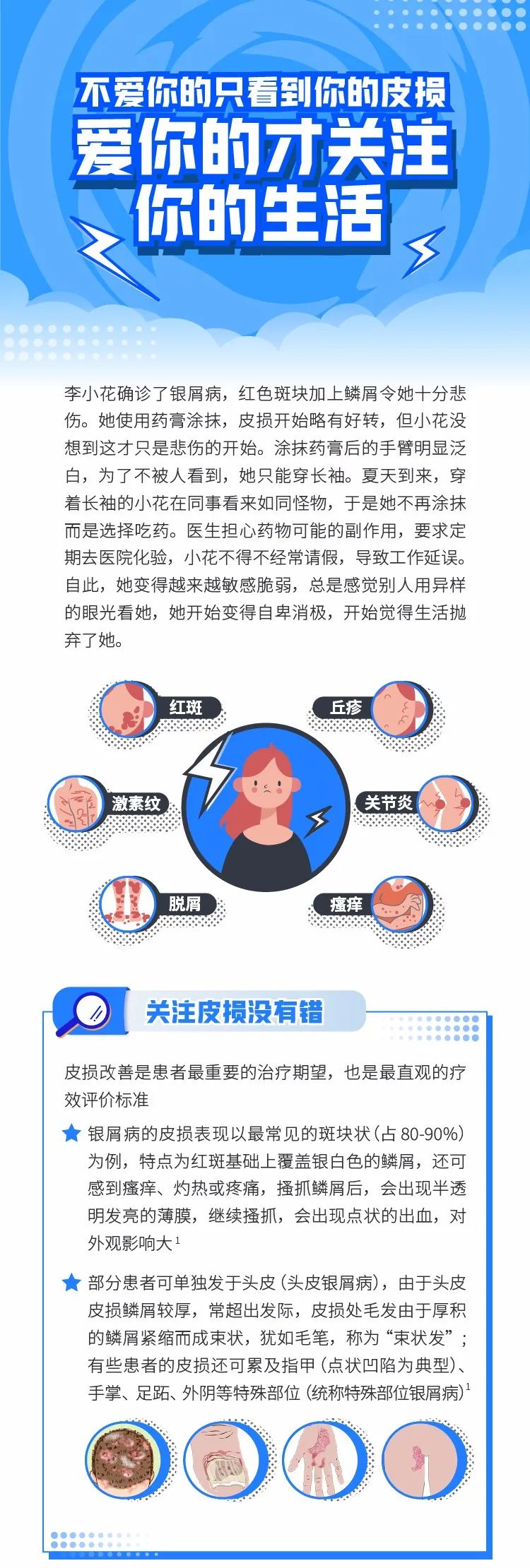 不爱你的只看到你的皮损，爱你的才关注你的生活！