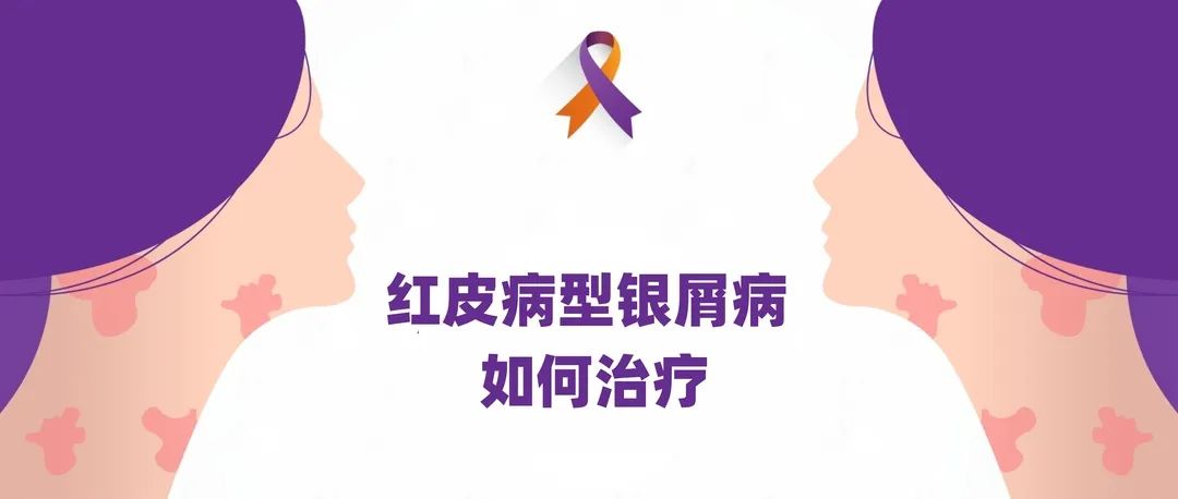 指南｜红皮病型银屑病如何治疗