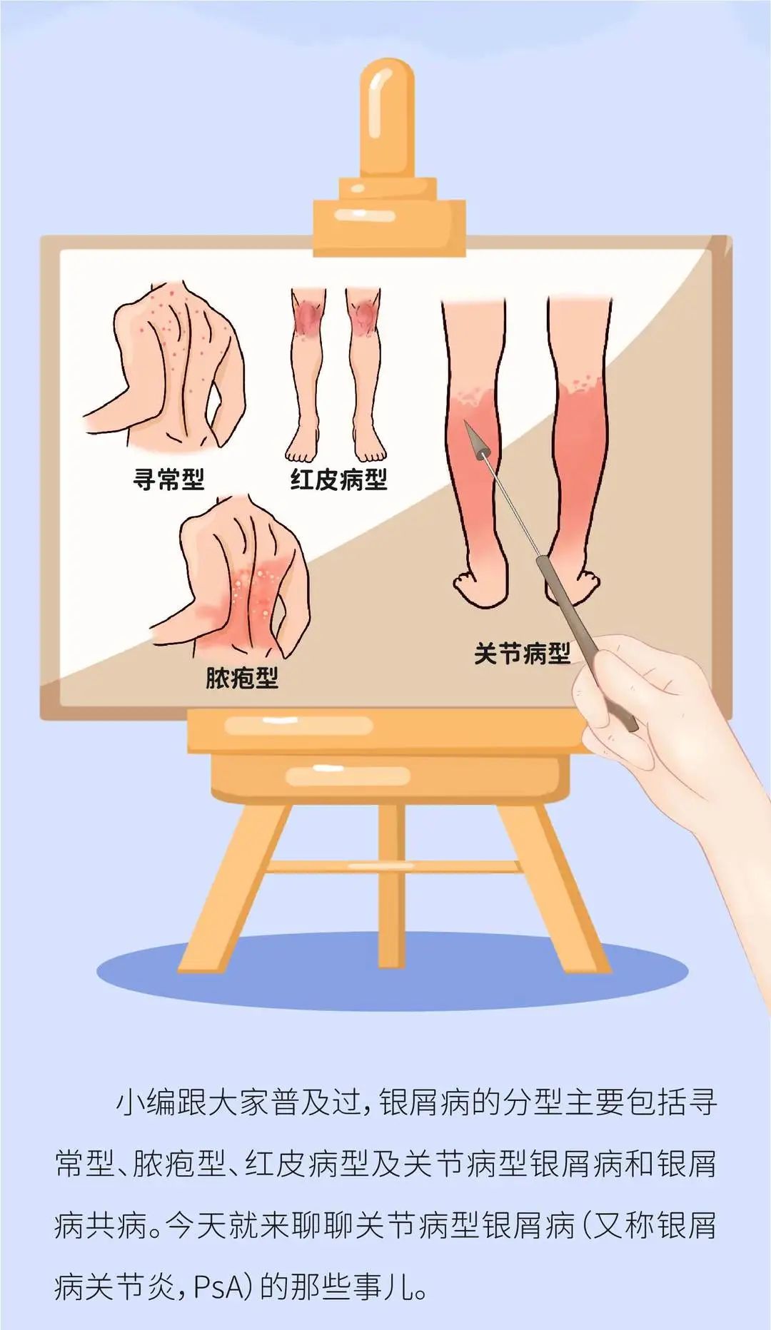 银屑病关节炎（PsA）应该控制到什么程度？