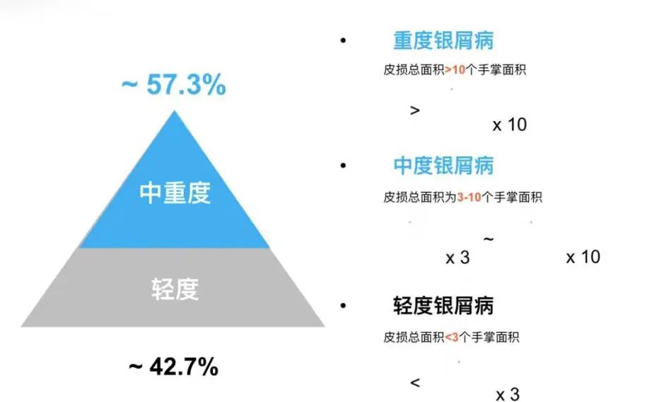 银屑病的相关知识，您真的了解吗？