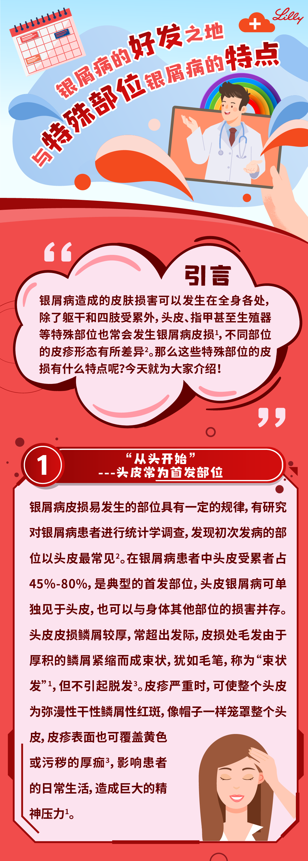 银屑病好发之地与特殊部位银屑病的特点