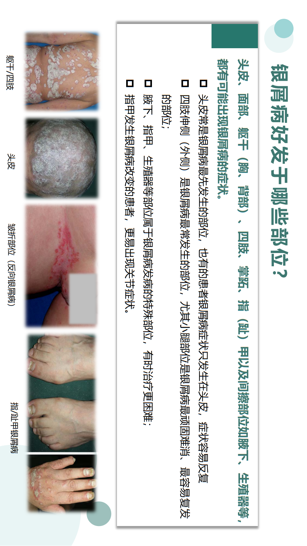 【银屑病科普手册】治疗用药、生物制剂疗法、疾病管理，患者必看