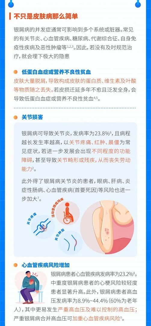 银屑病的治疗是场 “持久攻坚战”，知你辛苦，盼你坚持！