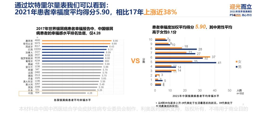 调研显示,中国银屑病患者幸福度相比2017年上涨近38%