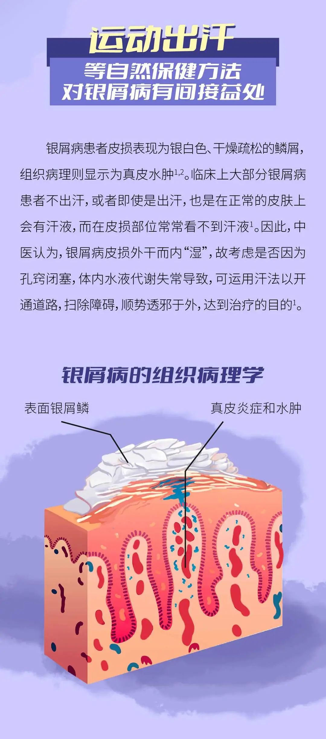 “运动出汗可以治好银屑病”，这个说法靠谱吗？
