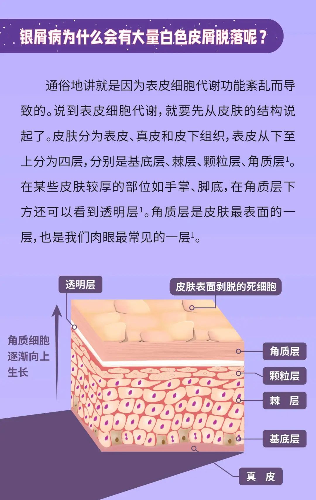 银屑病患者脱落皮屑的真相，原来是这样…