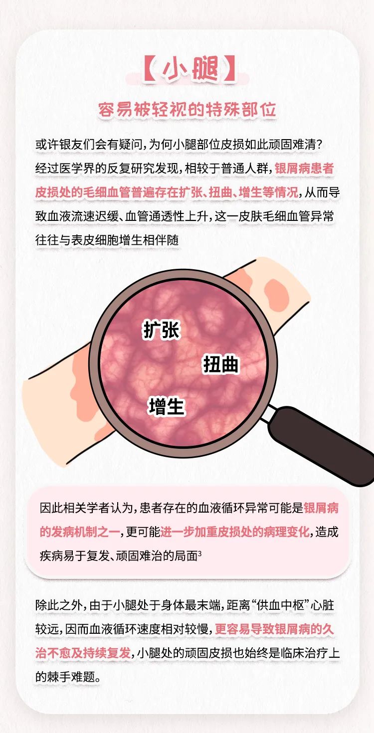 小腿皮损久不愈？现有良方解顽疾！