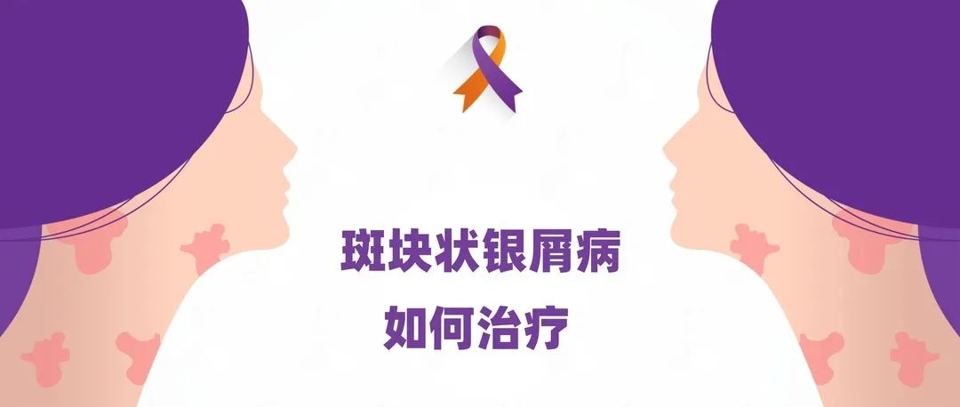 指南｜斑块状银屑病如何治疗