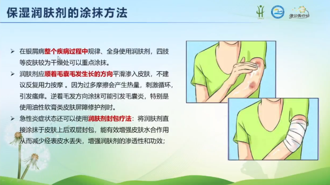 先擦药还是先润肤？专家告诉你答案
