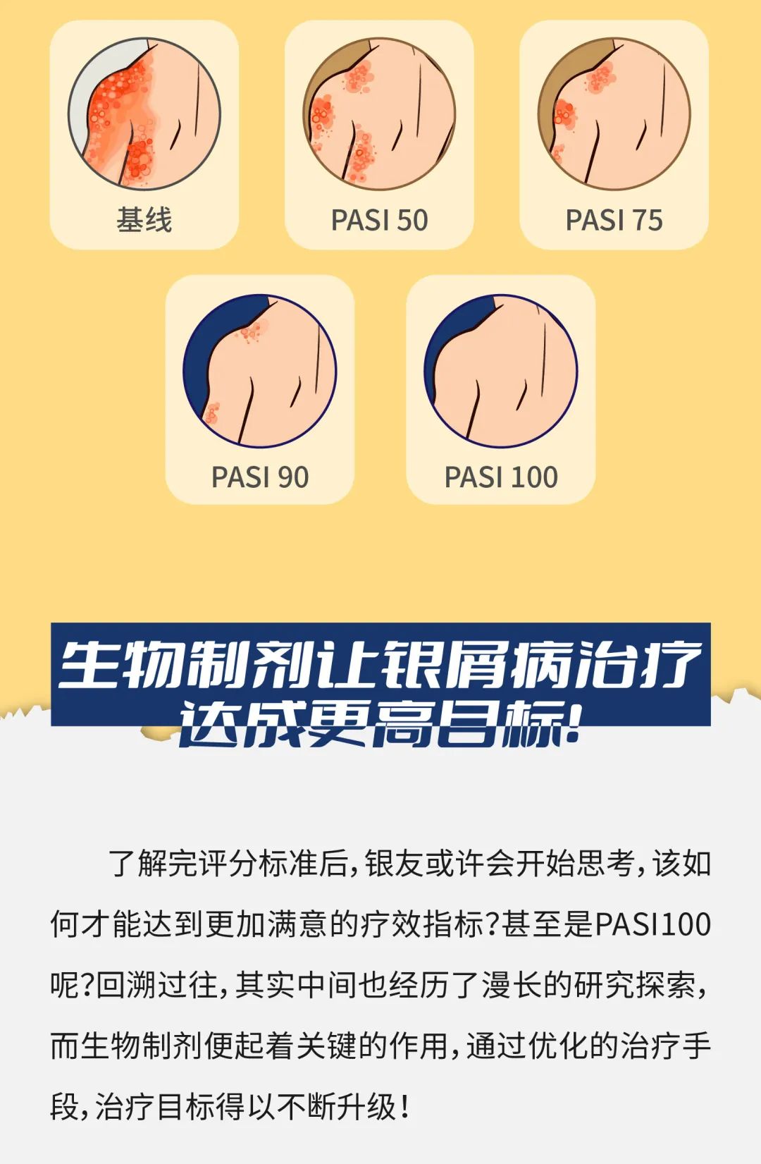 银屑病究竟应该治到什么地步？我现在这样应该满意吗？