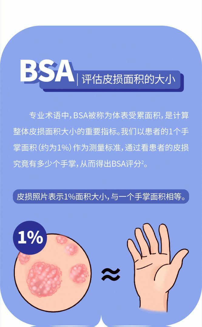皮损面积虽小，但长在这些部位算不算严重？