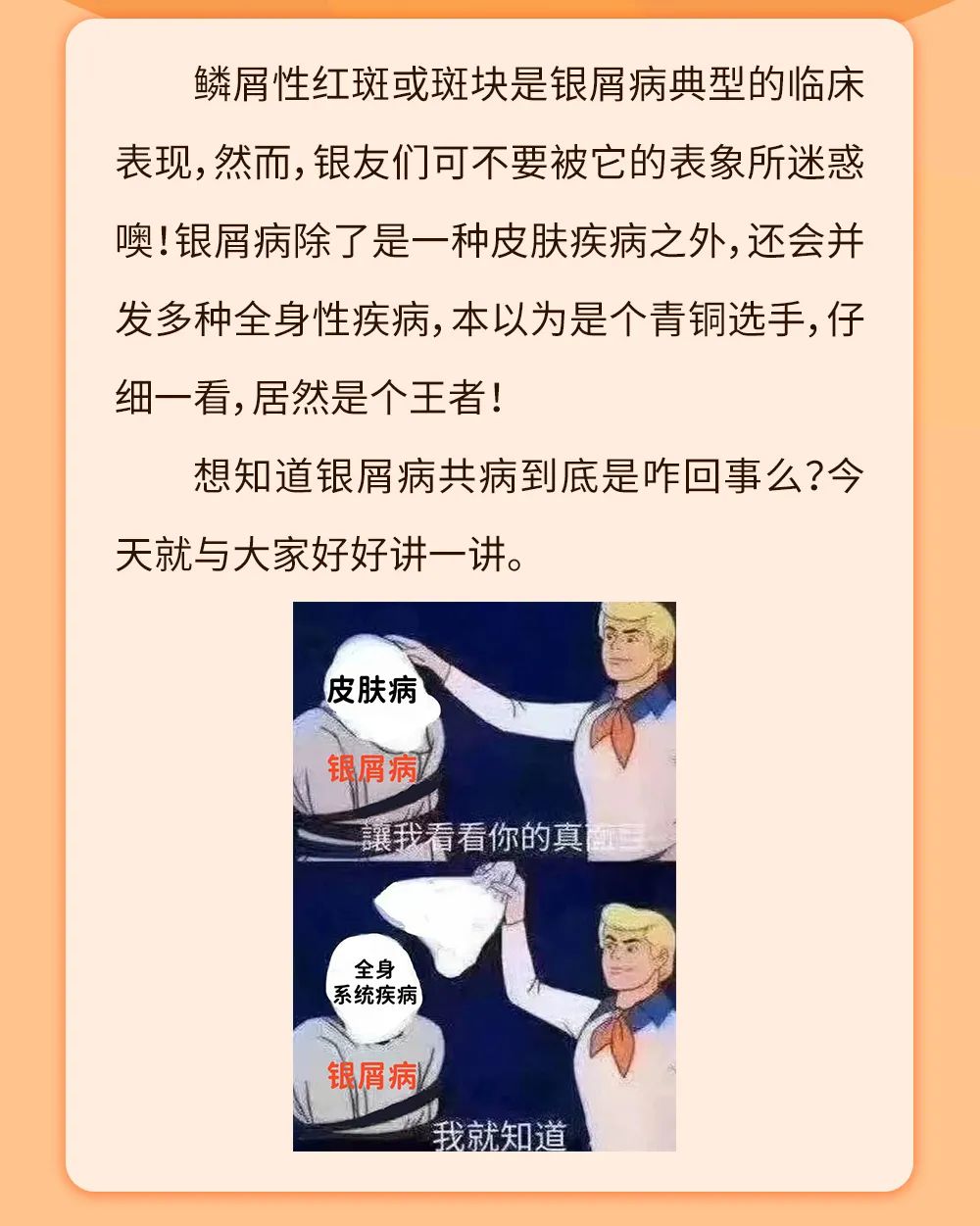 原来这些病可能都是银屑病的锅？