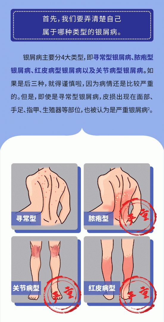 皮损面积虽小，但长在这些部位算不算严重？