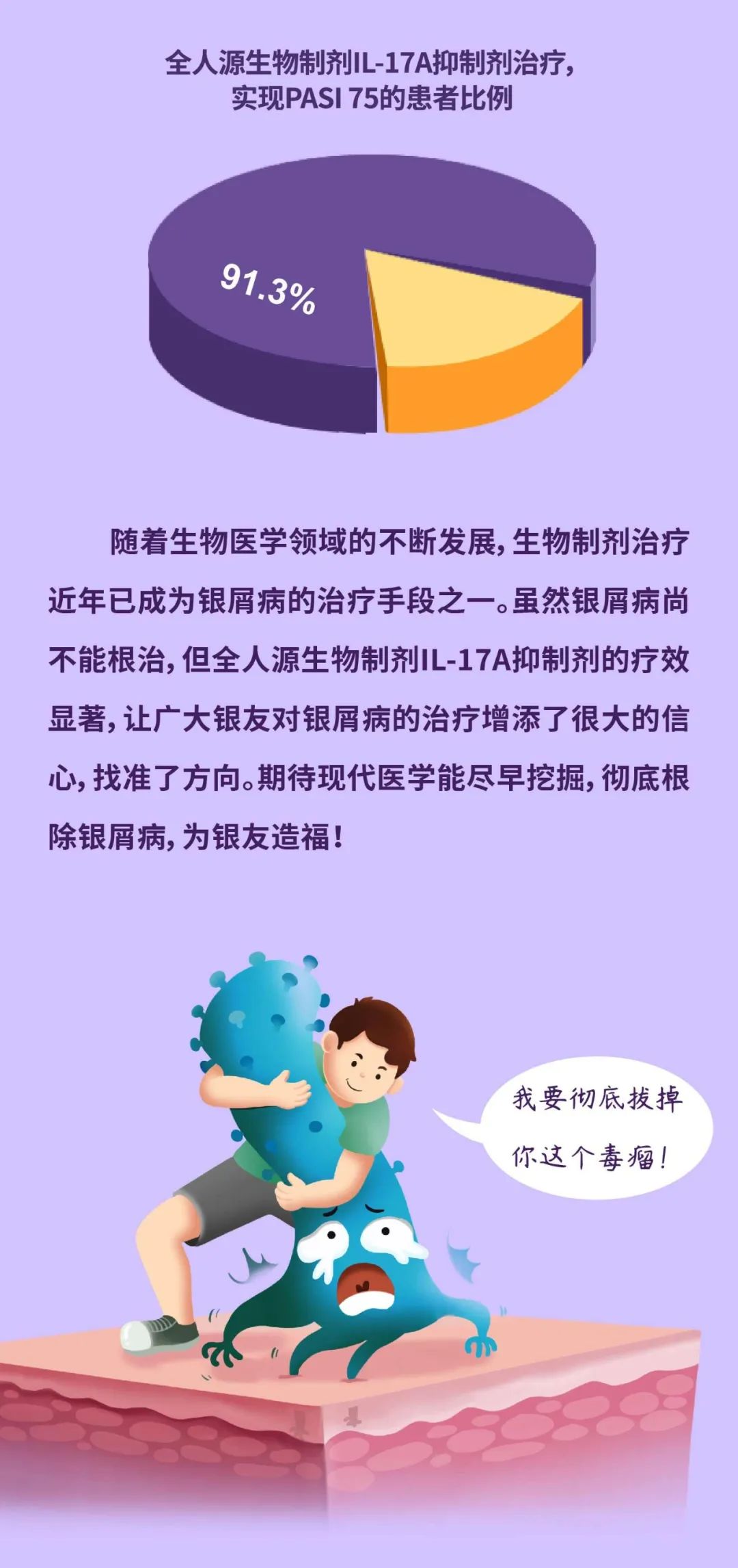治疗银屑病，找准方向才能一击即中