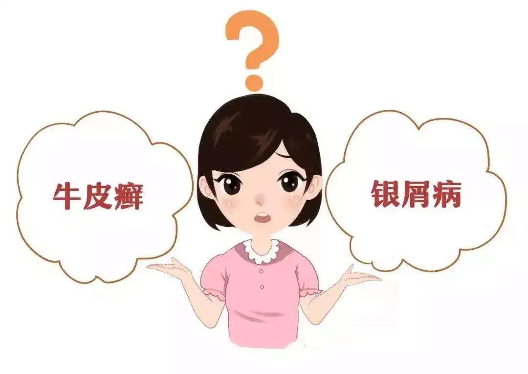 都在等这一天,告别“不死的癌症”银屑病