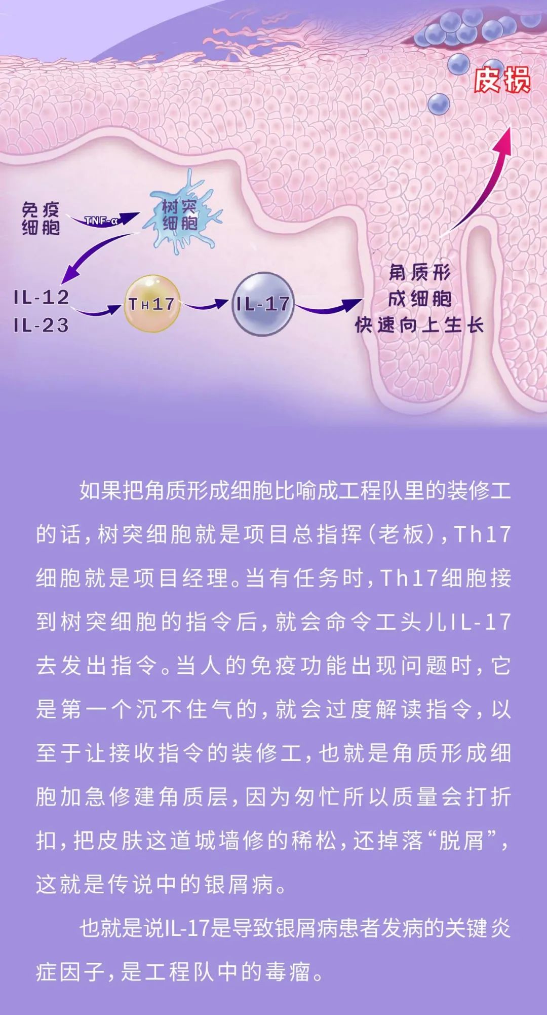 治疗银屑病，找准方向才能一击即中