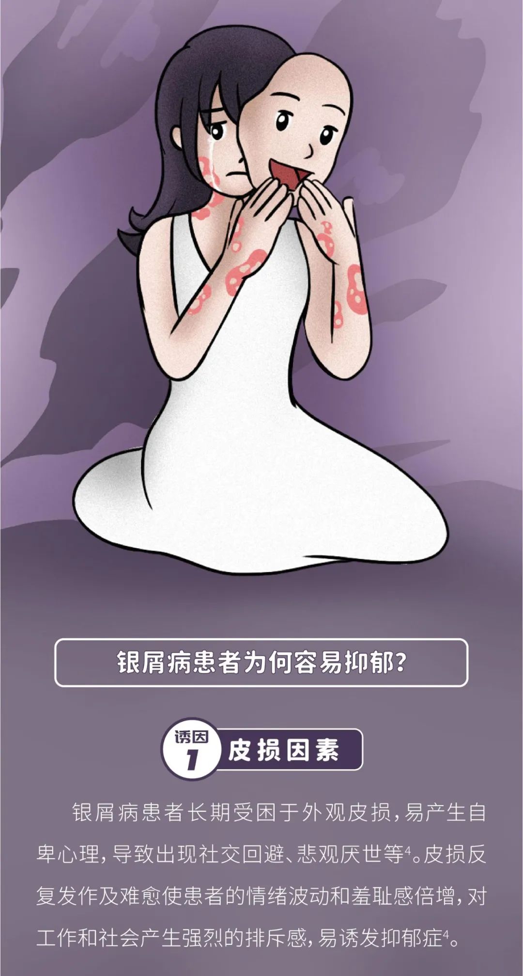抑郁症，银屑病患者无法诉说的痛！