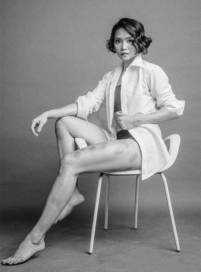她是菲律宾国家女排队队长，她是一名勇敢的抗银斗士