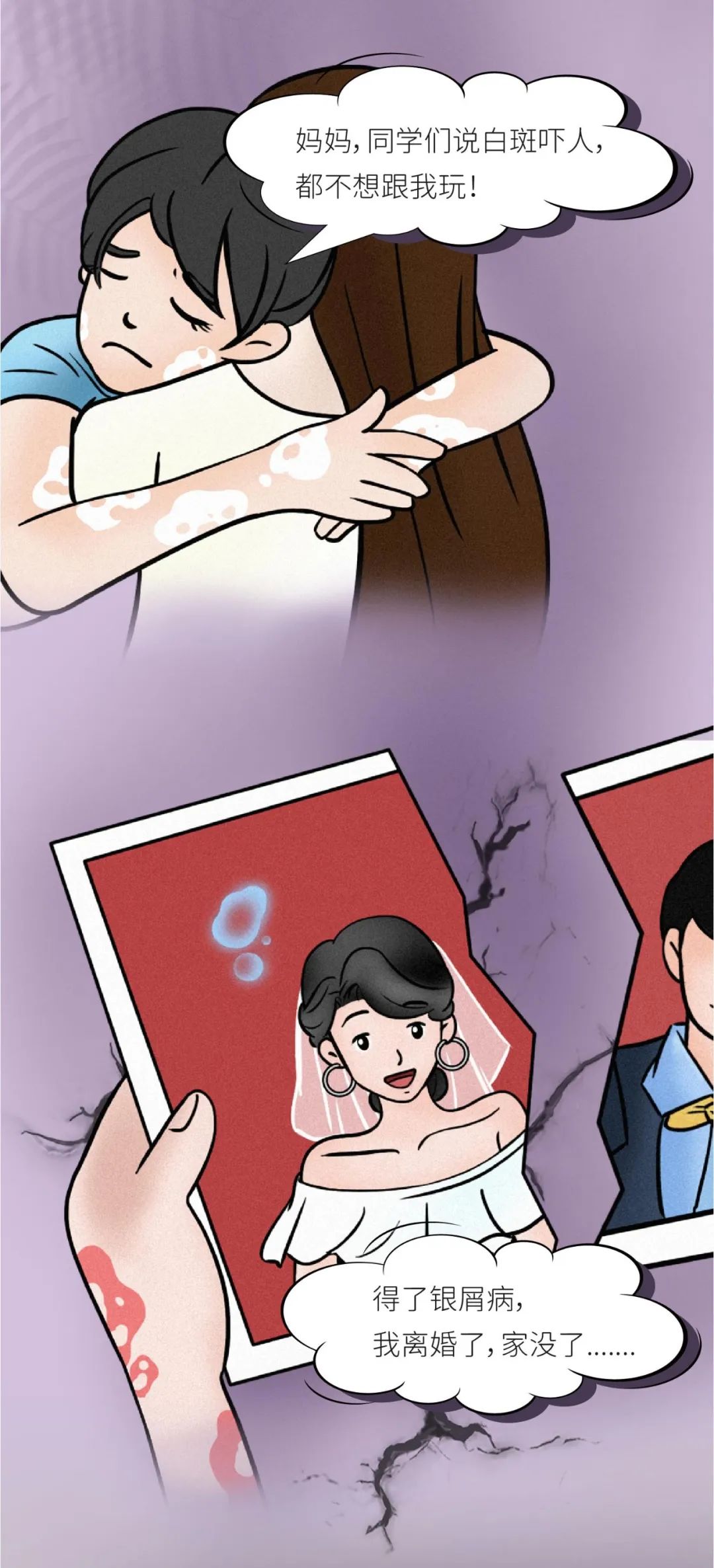 抑郁症，银屑病患者无法诉说的痛！