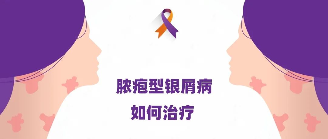 指南｜脓疱型银屑病如何治疗