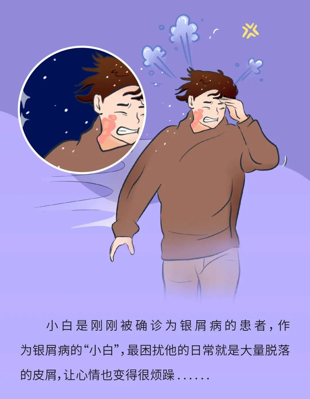 银屑病患者脱落皮屑的真相，原来是这样…