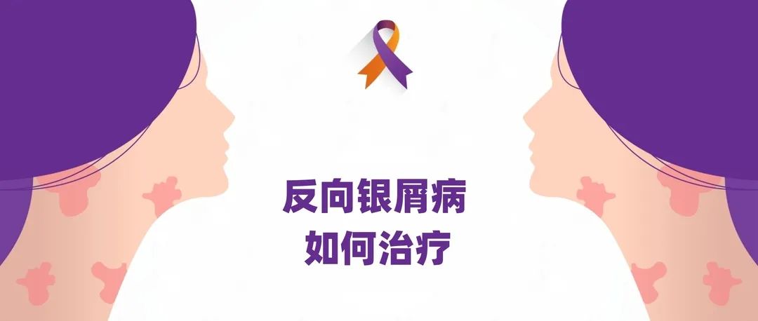 指南｜反向银屑病如何治疗
